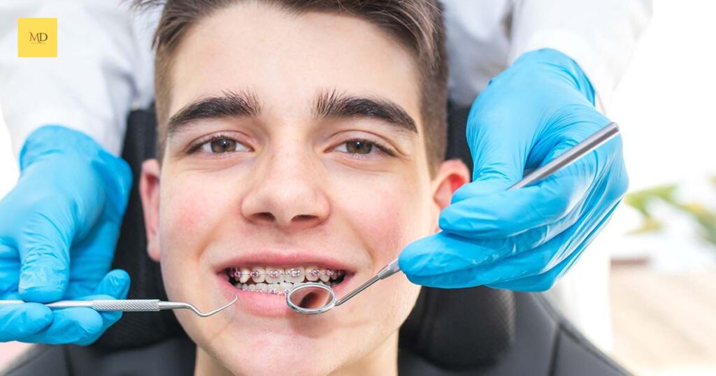 Navigating Security with Braces